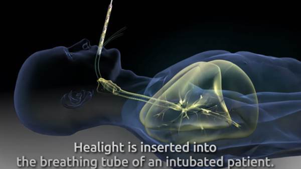 UV light inserted into body